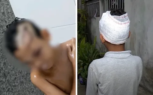 
          Imagem ilustrativa da imagem Menino de 8 anos é atacado por cachorro em Vila Velha e fica ferido
          