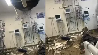Imagem ilustrativa da imagem Forro do teto desaba e paciente é atingida no Hospital da Restauração