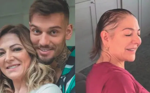 
          Imagem ilustrativa da imagem Alopecia: causas e tratamentos da doença que afeta famosos
          