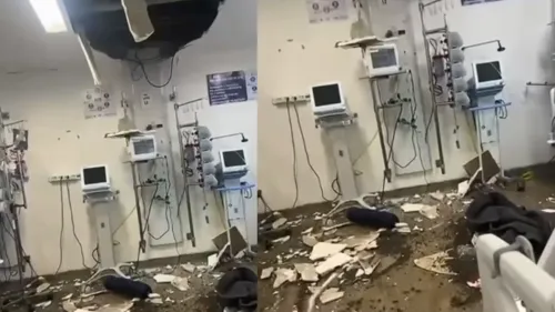 
          Imagem ilustrativa da imagem Forro do teto desaba e paciente é atingida no Hospital da Restauração
          