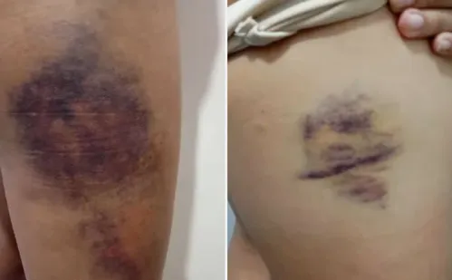 
          Imagem ilustrativa da imagem Jovem é espancada e bebê é ameaçado após suspeitos invadirem casa na Serra
          