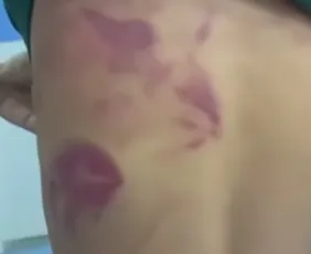 Imagem ilustrativa da imagem Pai é preso após agredir filho de 13 anos por usar brinco