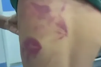 Imagem ilustrativa da imagem Pai é preso após agredir filho de 13 anos por usar brinco