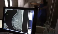 Imagem ilustrativa da imagem Planos de saúde terão que cobrir mamografia digital para todas as idades