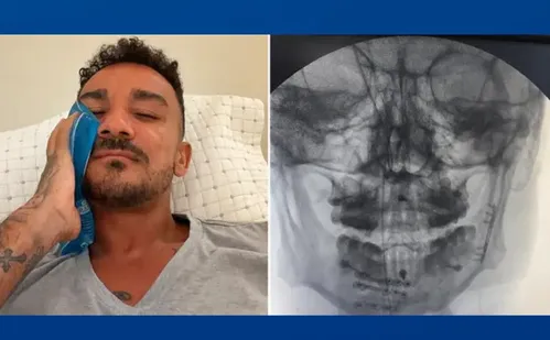 
          Imagem ilustrativa da imagem Danilo, do Flamengo, mostra recuperação após fratura na mandíbula
          