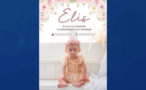
          Imagem ilustrativa da imagem Morre Elis, gêmea com síndrome de envelhecimento precoce; entenda a doença
          