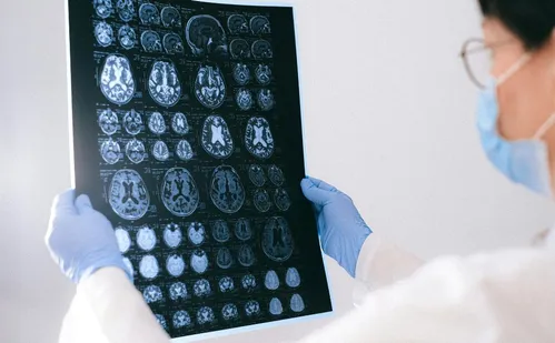 
          Imagem ilustrativa da imagem Pesquisadores desenvolvem método para prever Alzheimer antes dos primeiros sinais
          