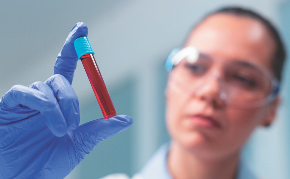 Exame de PSA não exige jejum, mas é importante seguir as orientações
do laboratório responsável pela coleta