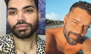 Imagem ilustrativa da imagem Ator faz mais de 30 cirurgias para se parecer com Ricky Martin e quase fica cego