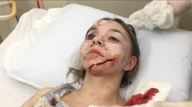 Taylor Hickson precisou ser levada com urgência para o hospital. Foto: Divulgação