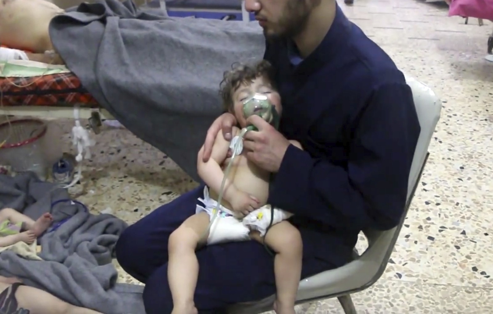 Criança é atendida após ataque na Síria. Foto: Syrian Civil Defense White Helmets