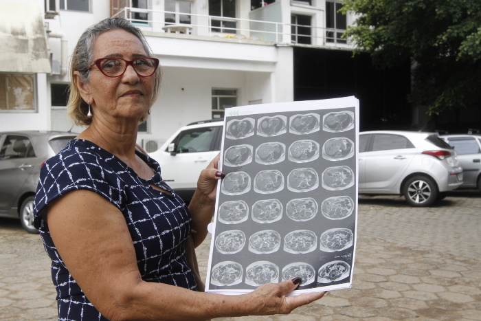 Há um ano, a aposentada Lucimar Oliveira, 65, aguarda consulta com oftalmologista e otorrinolaringologista pelo Sistema Único de Saúde (SUS). Foto: Lucimar Oliveira