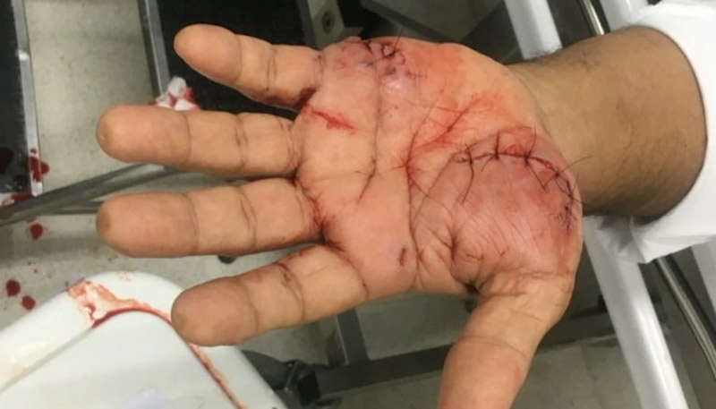 Portuário precisou levar 11 pontos nas mãos (Foto: Reprodução/TV Tribuna)