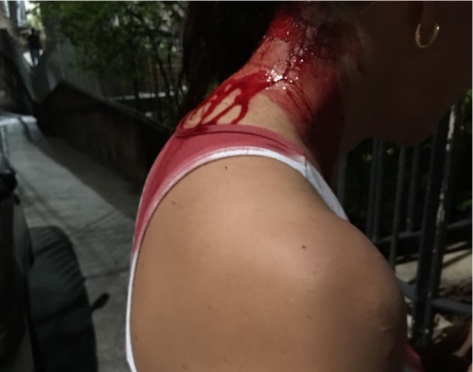 Ela ficou com a cabeça sangrando após várias coronhadas. (Foto: Acervo pessoal)