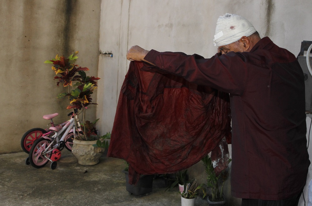 Com a cabeça enfaixada, taxista mostra uniforme, que era cinza, ensanguentado. (Foto: Fábio Nunes/AT)