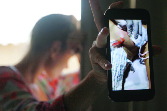 Educadora física mostra, no celular, foto da cirurgia que precisou fazer para retirar pus. (Foto: Leone Iglesias)