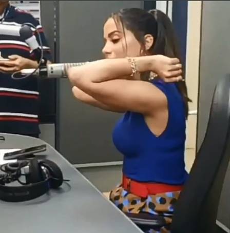 Anitta mostra os cotovelos machucados. (Foto: Reprodução/Instagram)