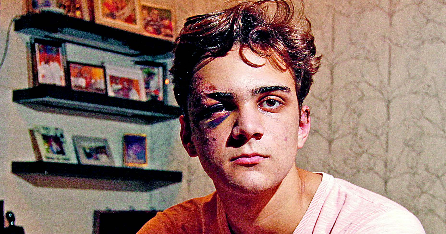 Cláudio Benincá foi agredido com pedra (Foto: Thiago Coutinho)