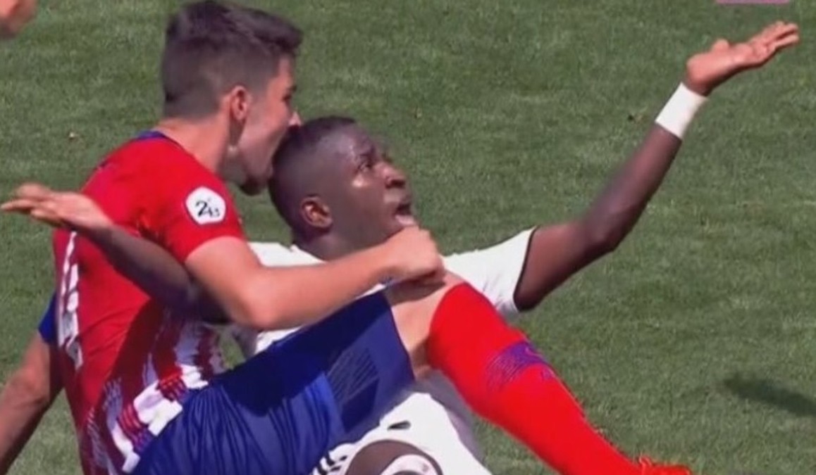 Atacante levou uma mordida na cabeça em sua segunda partida oficial (Foto: Reprodução)
