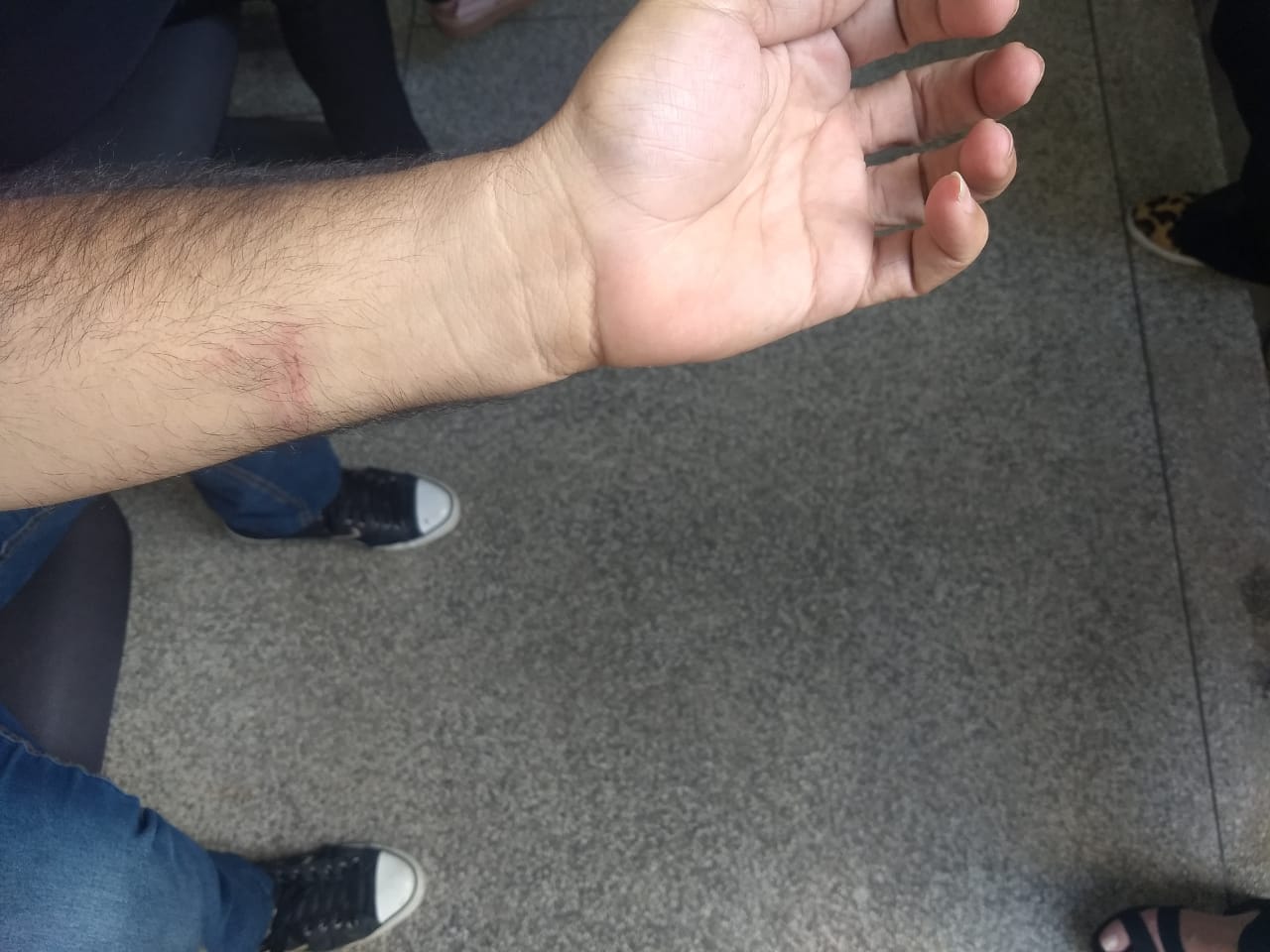 Conselheiro tutelar mordido durante tentativa de assalto (Foto: Tais de Hollanda)