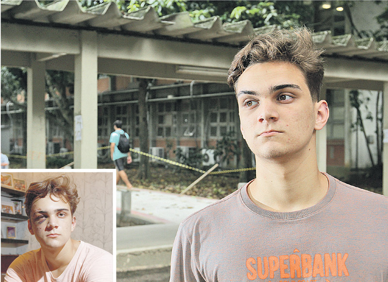 Cláudio Benincá é estudante de Engenharia da Ufes e foi ferido com pedra de 10 quilos em assalto (destaque) (Foto: Thiago Coutinho / AT - 22/09/2018)