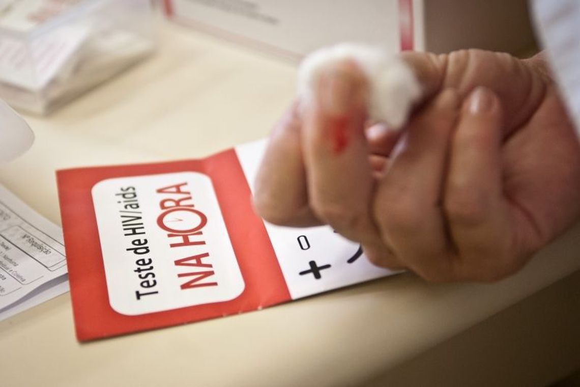Teste de HIV/Aids (Foto: Agência Brasil)