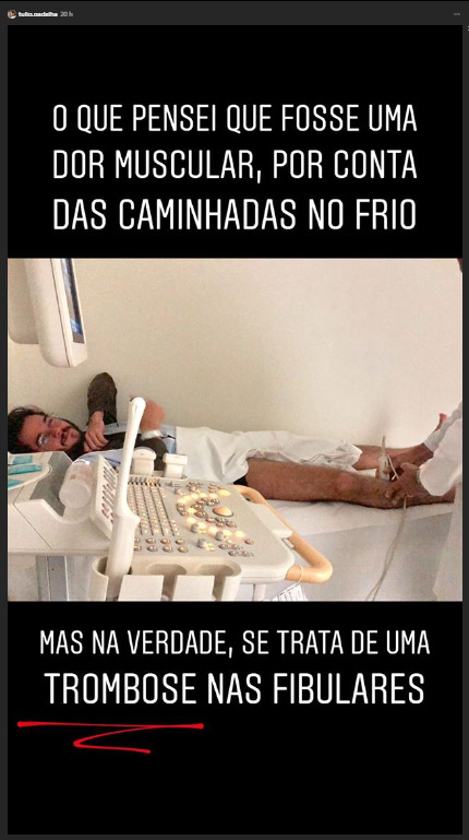 Túlio Gadelha falou sobre a trombose nas redes sociais (Foto: Reprodução / Instagram Stories)