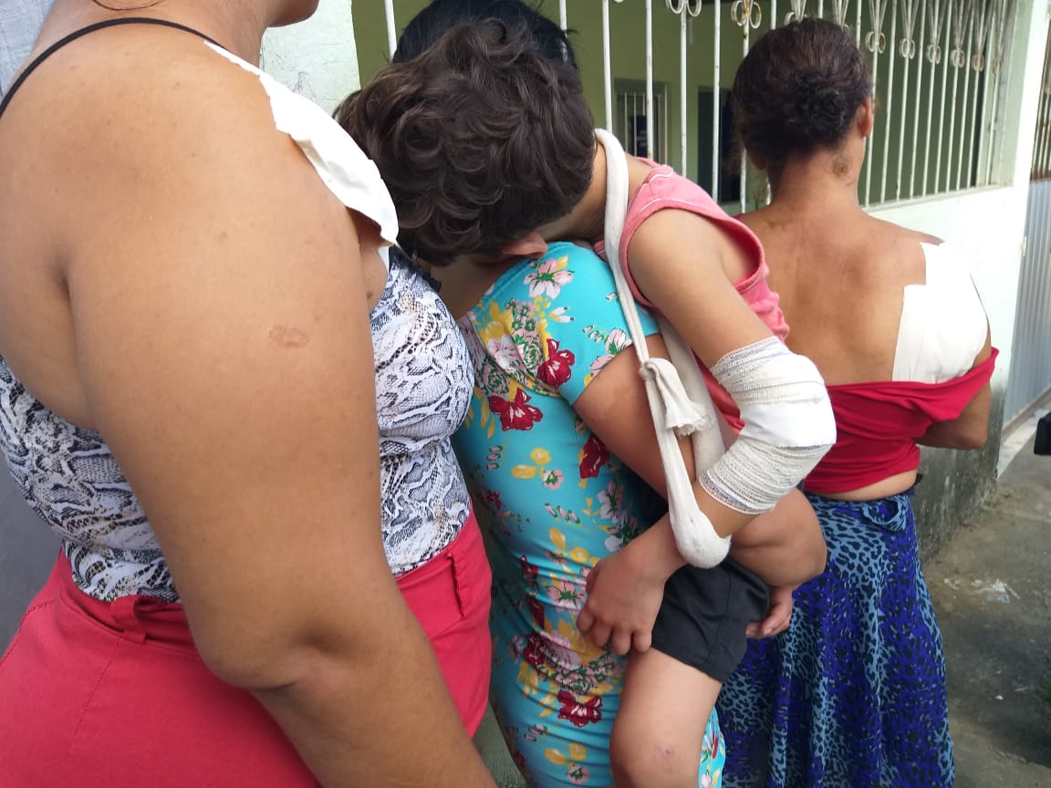 Vítimas de balas perdidas em troca de tiros (Foto: Simony Giuberti)