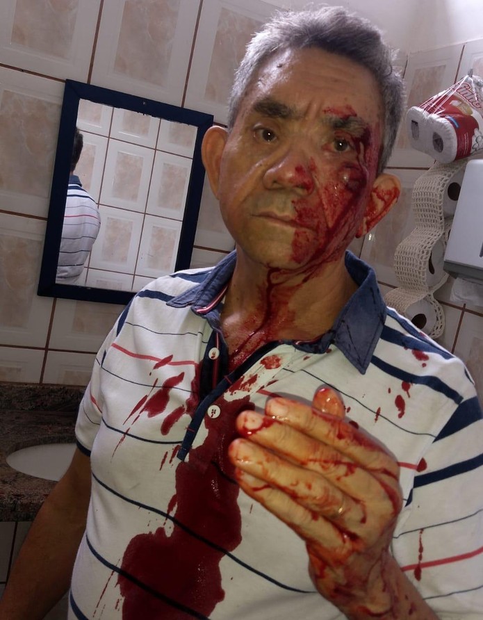 Professor precisou levar seis pontos no rosto e dois no supercílio após agressão (Foto: Acervo pessoal)