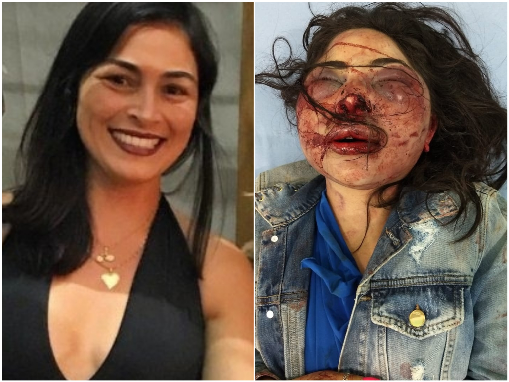 Jane Cherobin da Silva, de 36 anos, ficou com o rosto irreconhecivel após agressões. (Foto: Acervo pessoal)