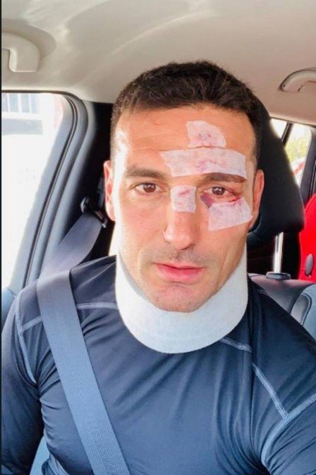 Técnico da seleção da Argentina é atropelado por carro na Espanha (Foto: Reprodução/Instagram)