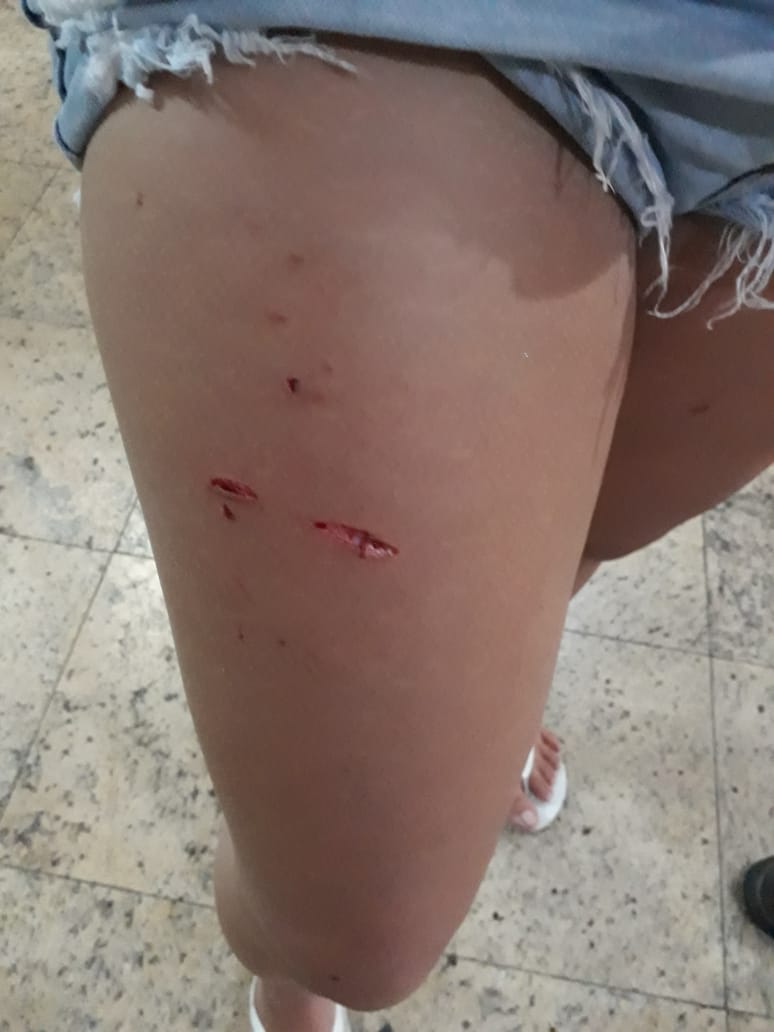 Torcedora foi agredida com garrafa de cerveja (Foto: Patricia Maciel)