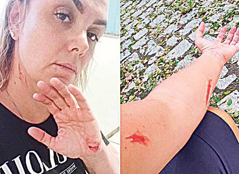 Ana Paula Almeida admitiu que fez machucados por estar com raiva (Foto: Divulgação)
