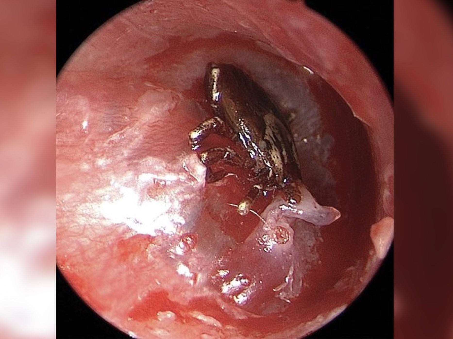 (Foto: The New England Journal Of Medicine)