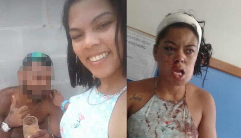 Rauliane ficou com o rosto desfigurado por conta das agressões sofridas (Foto: Acervo pessoal)