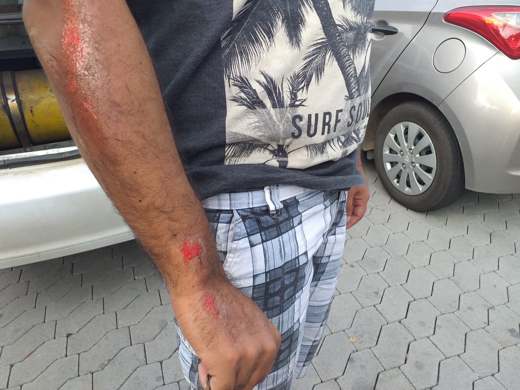 Taxista ficou machucado após pular do veículo (Foto: Simony Giuberti)