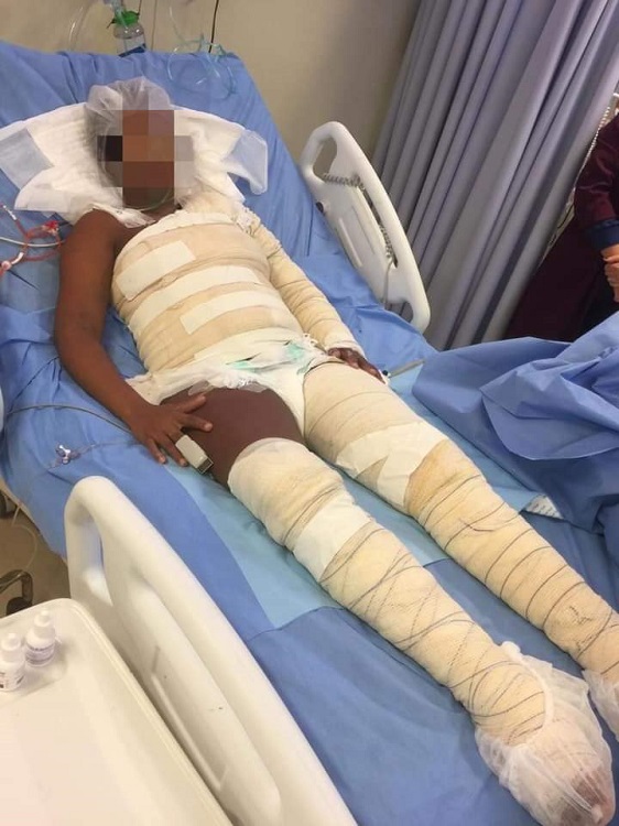 Foto mostra resultado da agressão sofrida pela vítima, de 26 anos (Foto: Divulgação/Polícia Civil)