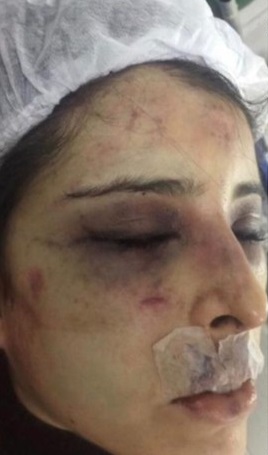 Rosto da médica agredida pelo namorado lutador (Foto: Inter TV RJ/Reprodução)