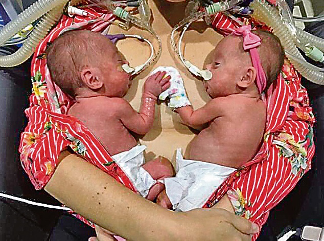 Bebês recebem carinho da mãe (Foto: Divulgaçãoi)