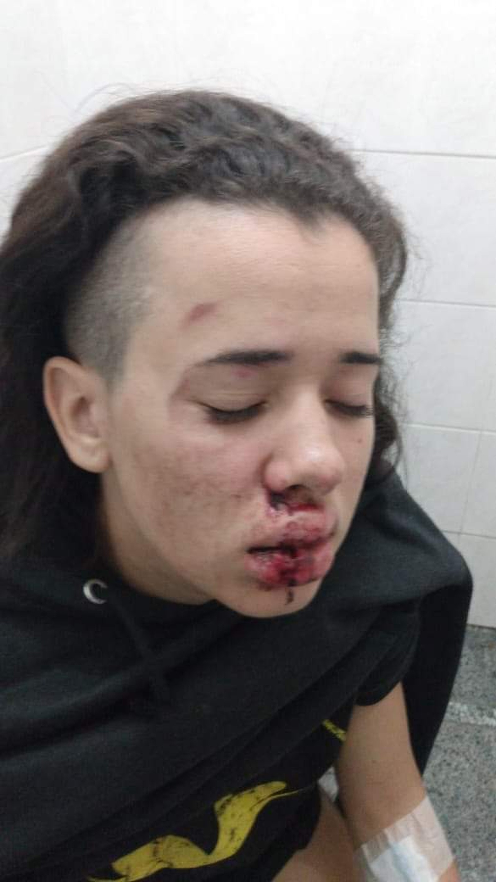 O jovem de 19 anos teve lesões no rosto, na costela e nas pernas. (Foto: Praia Grande Mil Grau)