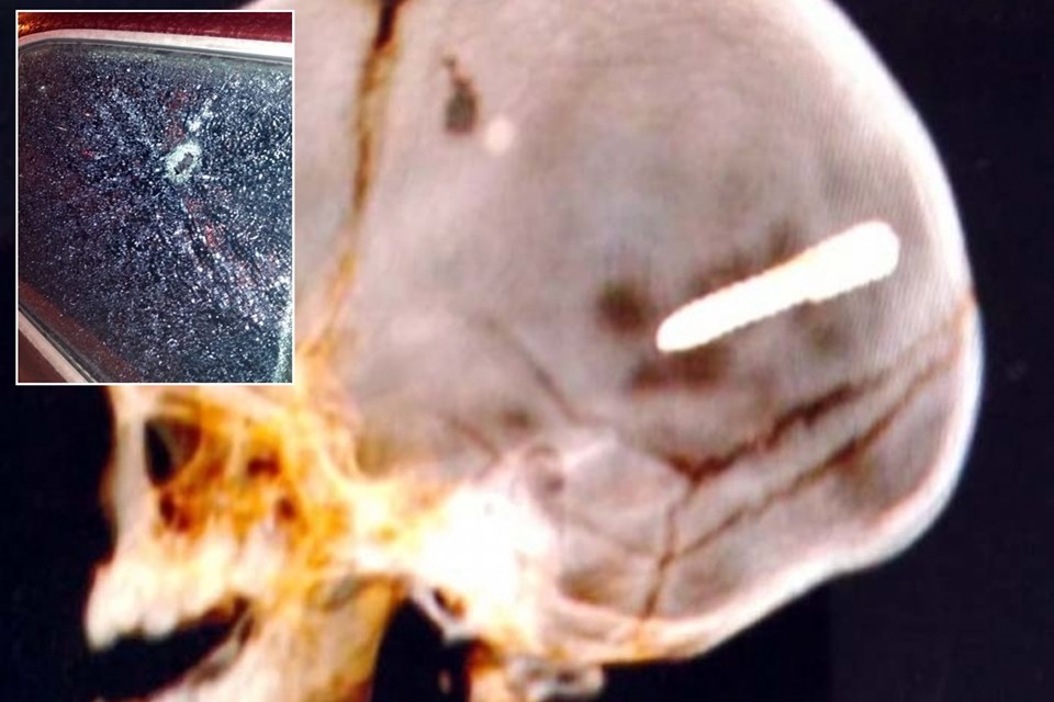 O prego atravessou o vidro traseiro do carro e perfurou o crânio do bebê de 10 meses (Foto: Divulgação)