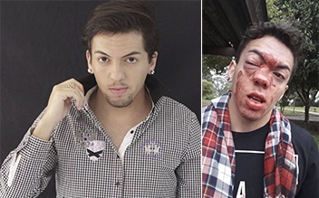 Ator publicou nas redes sociais fotos de seu rosto após a agressão (Foto: Facebook)