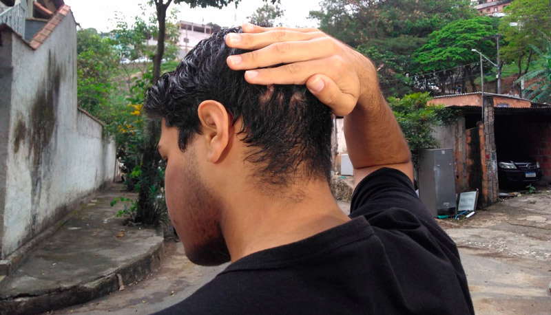 Estudante ficou ferido na cabeça após o assalto (Foto: Júlia Afonso / AT)
