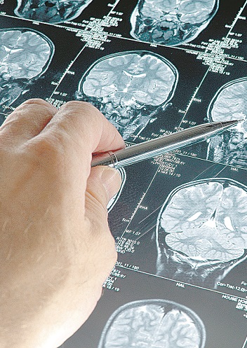 Mapeamento cerebral é analisado (Foto: Divulgação)