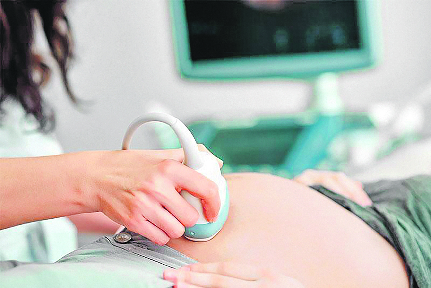 Médica faz ultrassonografia em gestante: exame identifica também anatomia do feto e até más-formações (Foto: Divulgação)