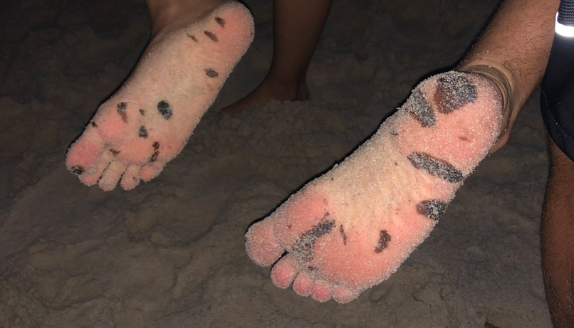 Whindersson postou foto dos pés dos turistas sujos de óleo (Foto: Reprodução / Twitter)
