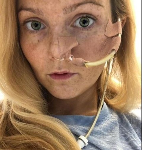 A britânica Jemma Levy fica ligada a tubos por 22 horas por dia. (Foto: Reprodução)