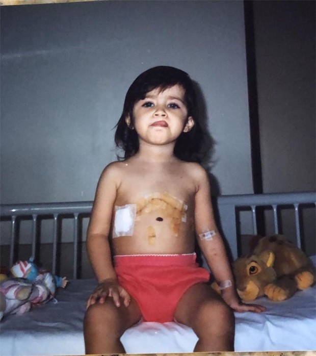 A influenciadora Jéssica Costa publicou uma foto de criança quando realizou cirurgia cardíaca. (Foto: Reprodução/Instagram)