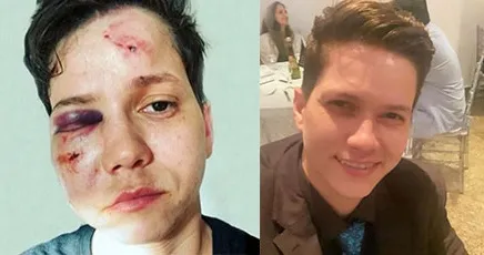 Imagem ilustrativa da imagem Youtuber Karol Eller prestou depoimento falso sobre homofobia, diz delegada
