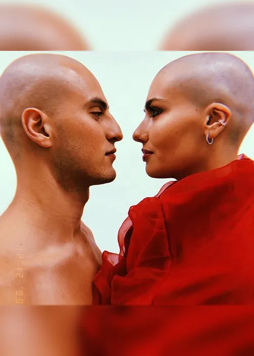 Imagem ilustrativa da imagem “Fiquei careca e me reinventei”, diz a modelo Giovanna Luconi